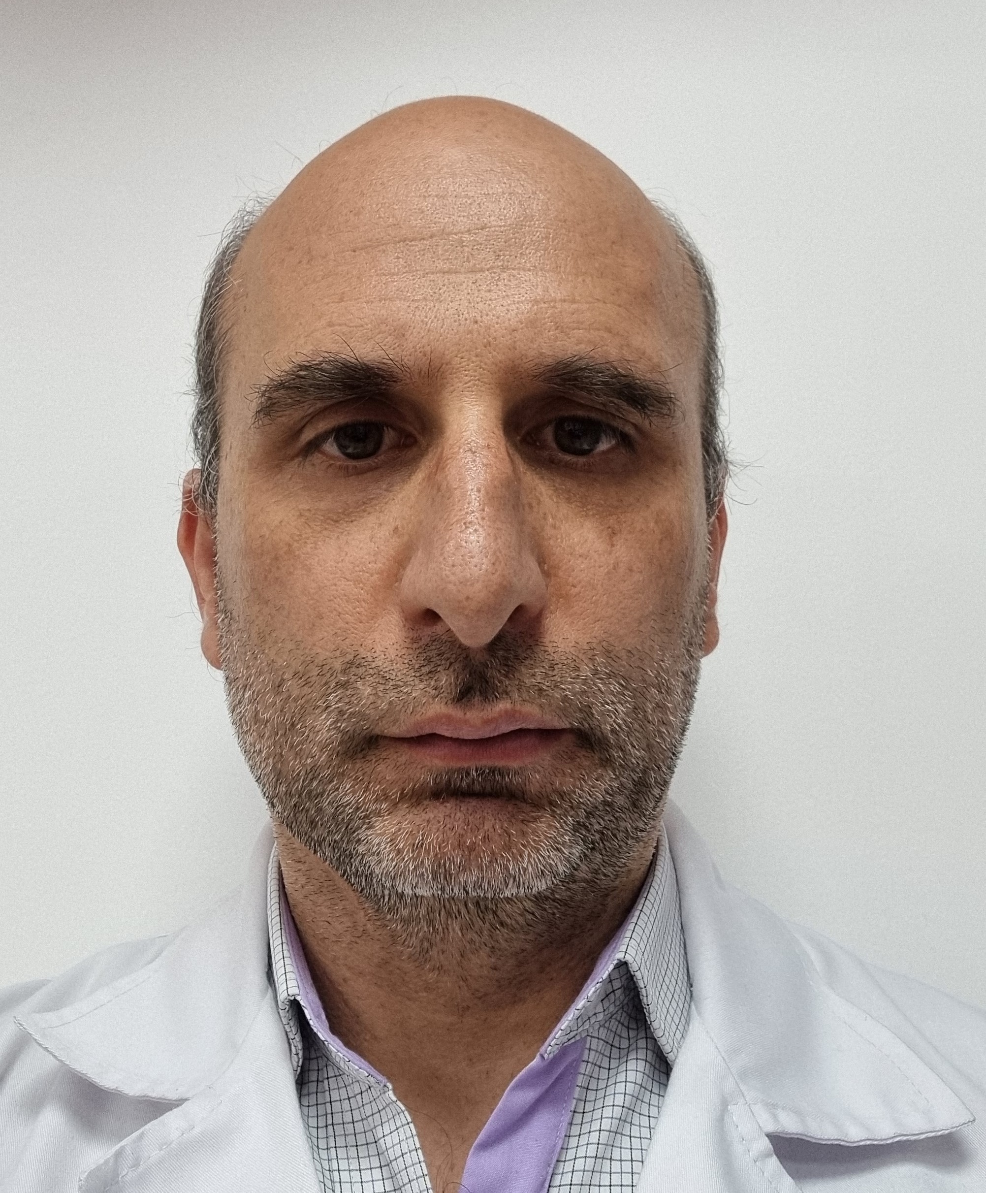 Calcificación miocárdica: una complicación excepcional de la neumonía y la sepsis